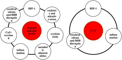 Venous stroke–a stroke subtype that should not be ignored